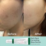 سرم ضد لک اکسیس وای مدل Dark Spot حجم 50 میلی لیتر - Image 4