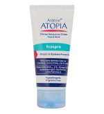 کرم اگزما صورت و گردن مدل Eczopro  اتوپیا آردن